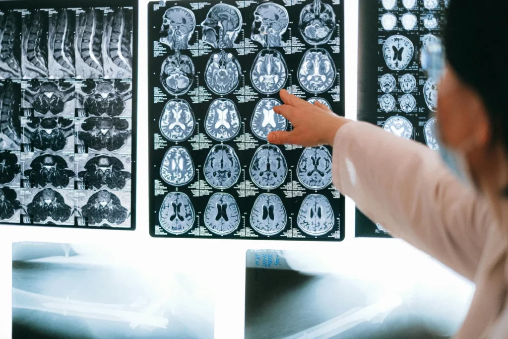 Photo de radiologie.